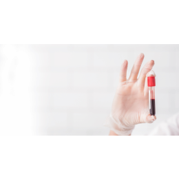 Grupy krwi u psa i kota - o czym należy wiedzieć?