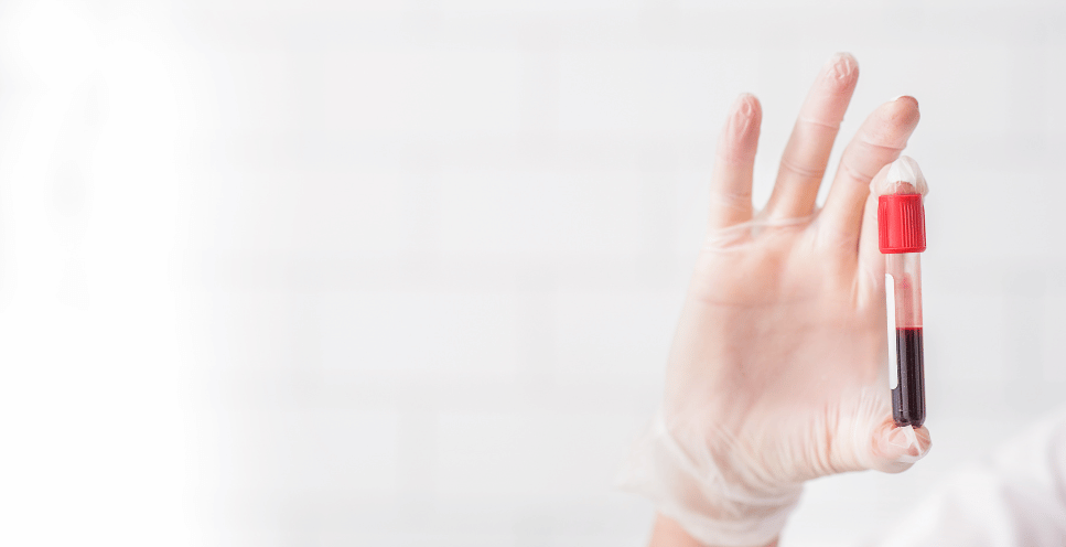 Grupy krwi u psa i kota - o czym należy wiedzieć?